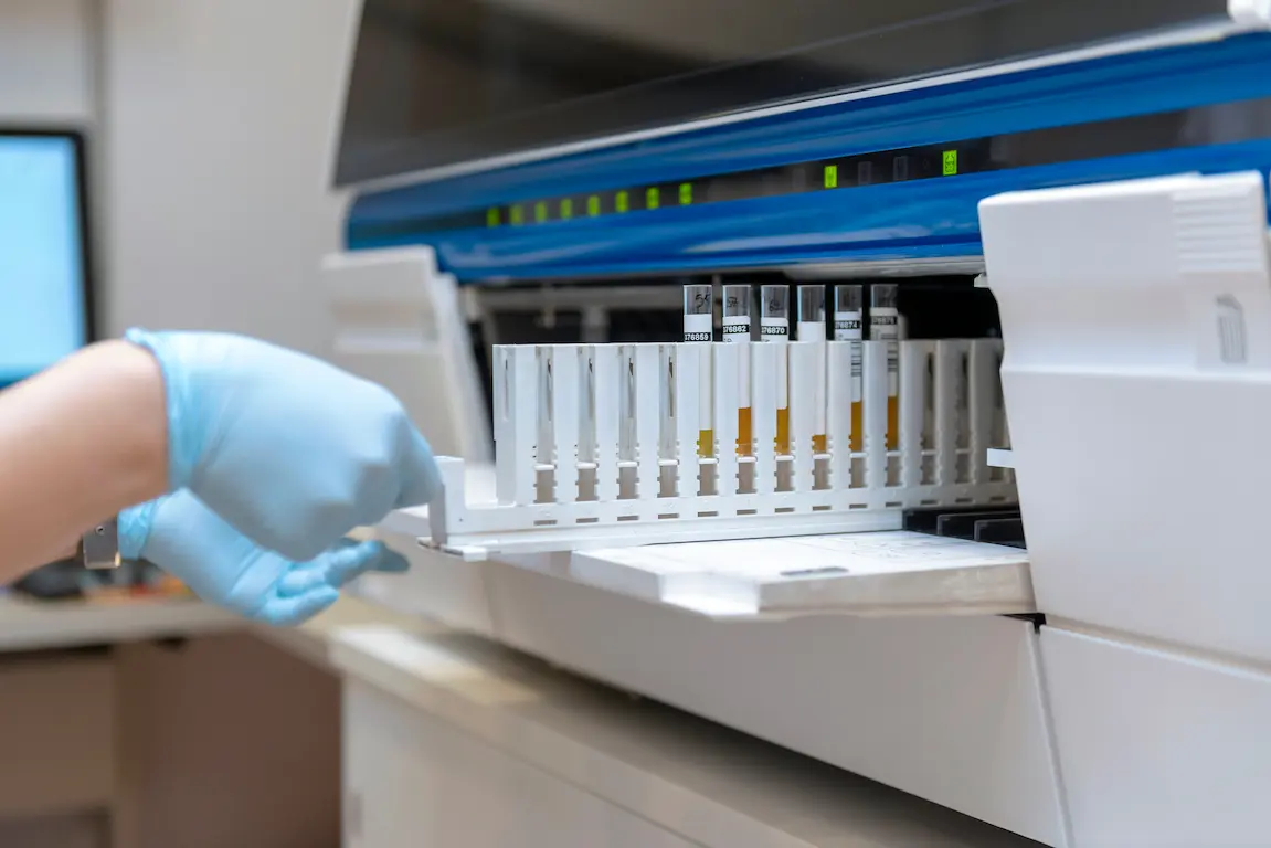 A gloved hand slides a tray of test tubes containing yellow liquid samples into a laboratory analysis machine.